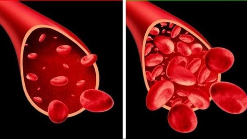 بمكون واحد من رفوف مطبخك .. تخلصي من الكوليسترول بدون أدوية