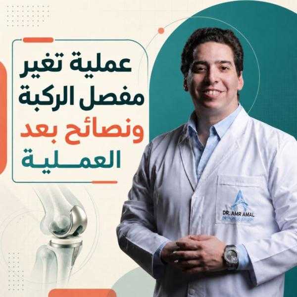 عملية تغير مفصل الركبة ونصائح بعد العملية
