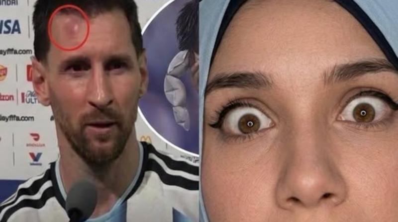 إصابة ميسي & علياء قمرون